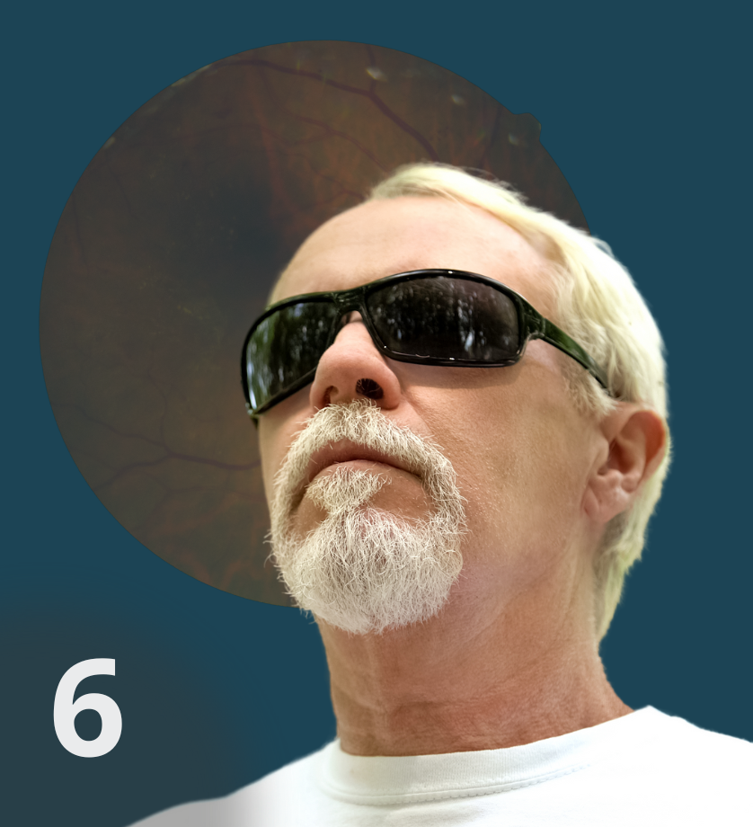 No momento, você está visualizando Manejo da retinopatia diabética